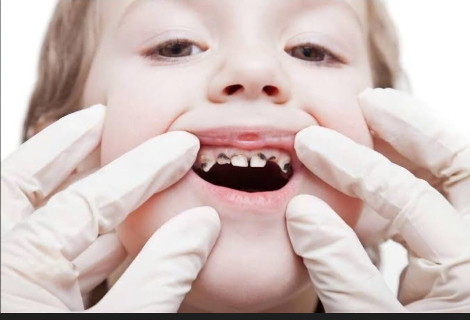 childrensteeth